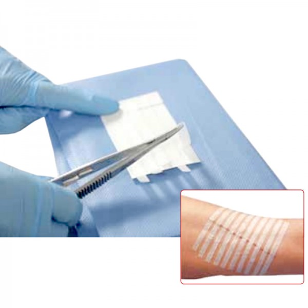 Plasturi inlocuire suturi chirurgicale, material netesut, sterili, 6x75mm, 3 buc/plic, PRIMA (50 plicuri/cutie)
